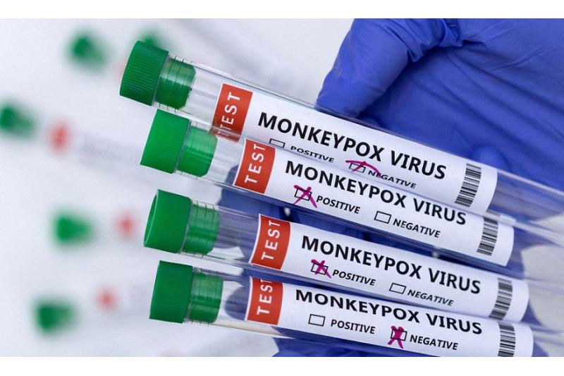 وكالة الأدوية الأوروبية توافق على استخدام لقاح مضاد للجدري