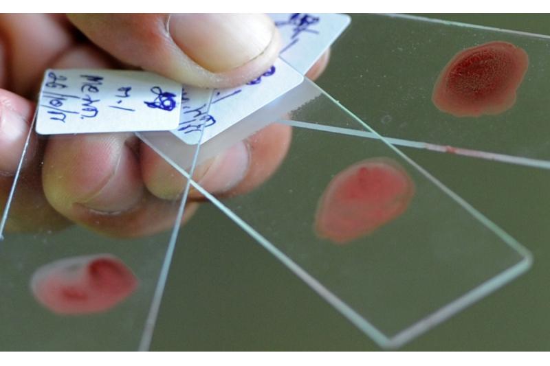 الصحة العالمية تؤكد ارتفاع عدد الإصابات بالملاريا في العالم إلى 247 مليونا